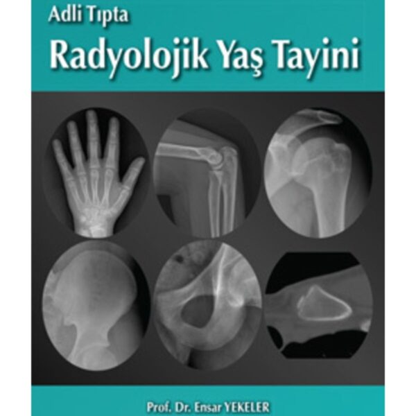 Adli Tıpta Radyolojik Yaş Tayini