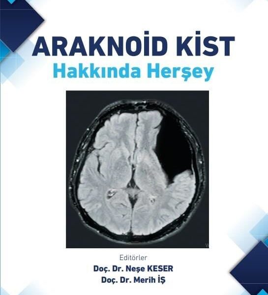 Araknoid Kist Hakkında Herşey
