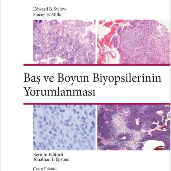 Baş ve Boyun Biyopsilerinin Yorumlanması