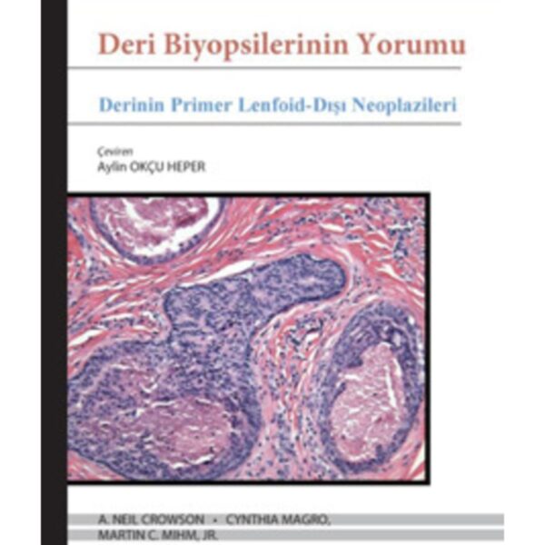 Deri Biyopsilerinin Yorumu: Derinin Primer Lenfoid-Dışı Neoplazileri
