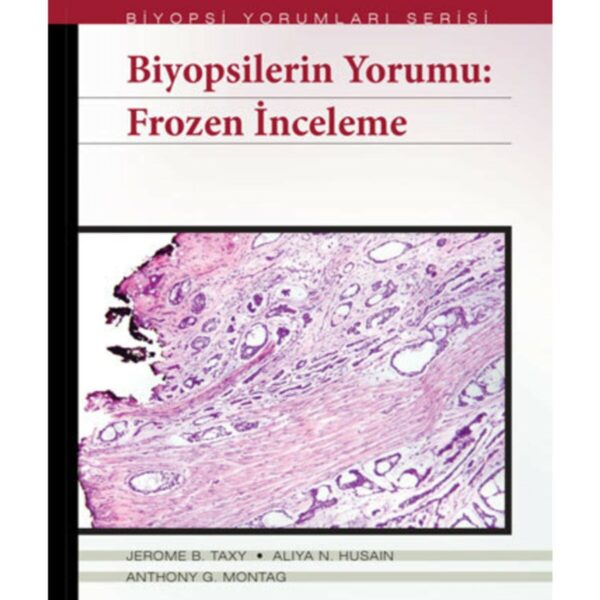 Biyopsilerin Yorumu: Frozen İnceleme - Biyopsi Yorumları Serisi