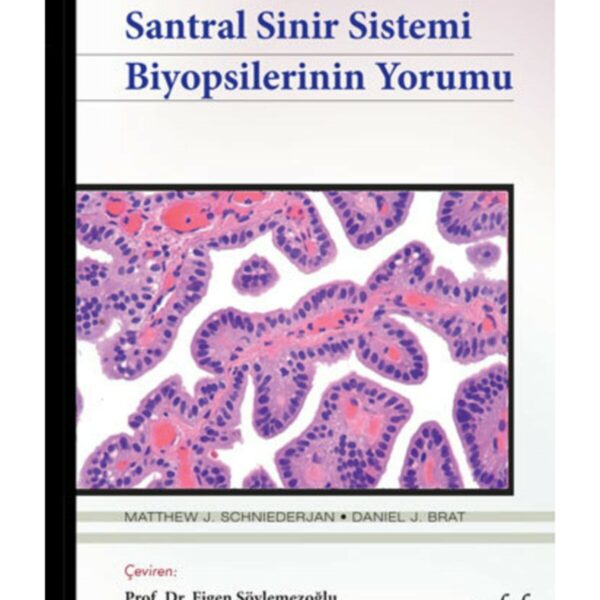 Santral Sinir Sistemi Biyopsilerinin Yorumu - Biyopsi Yorumları Serisi