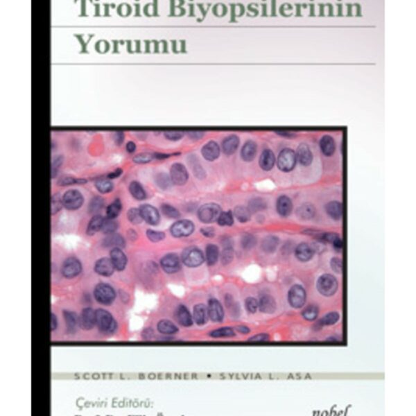 Tiroid Biyopsilerinin Yorumu - Biyopsi Yorumları Serisi