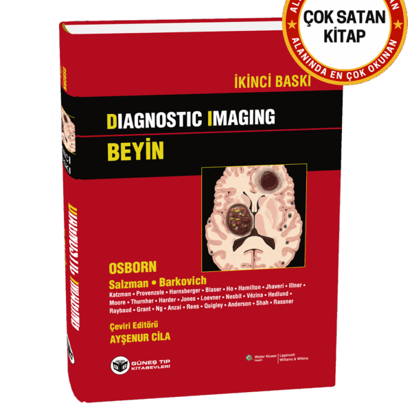Diagnostic Imaging - Beyin