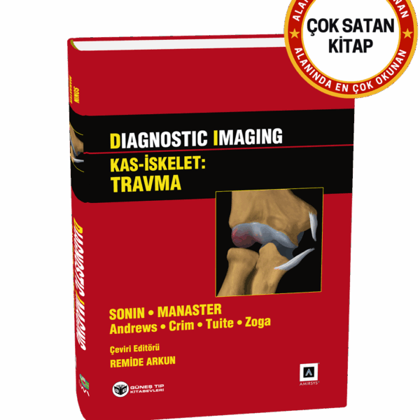 Diagnostic Imaging - Kas İskelet: Travma