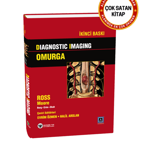 Diagnostic Imaging - Omurga