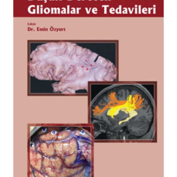 Düşük Dereceli Gliomalar ve Tedavileri