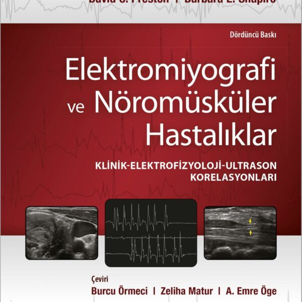 Elektromiyografi ve Nöromüsküler Hastalıklar-2022