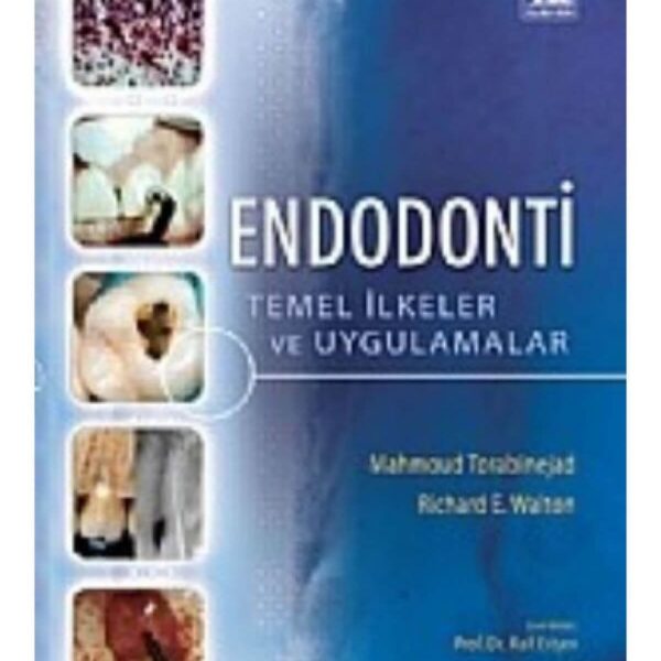 Endodonti Temel İlkeler ve Uygulamalar
