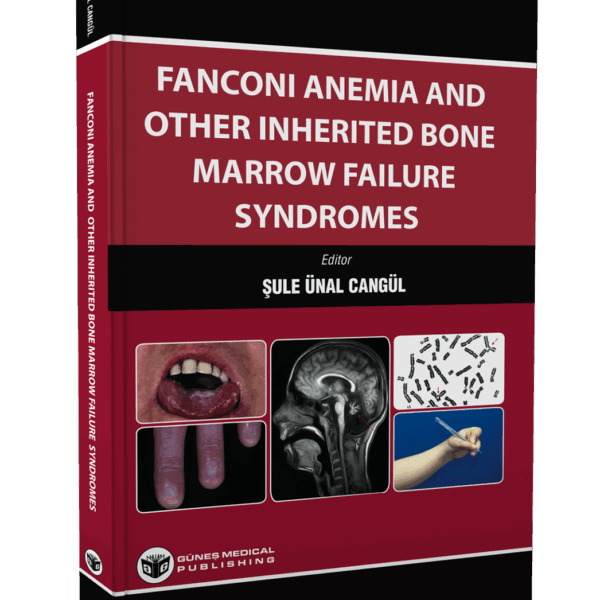 Fanconi Anemia And Other Inherited Bone Marrow Failure Syndromes