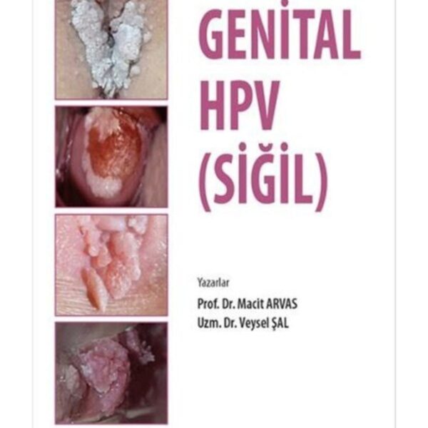 Genital HPV (SİĞİL)
