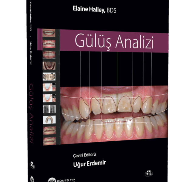 Gülüş Analizi