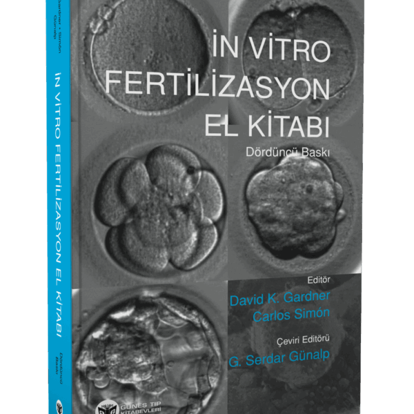 İn Vitro Fertilizasyon El Kitabı