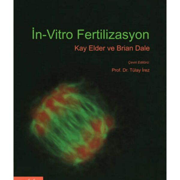 İn-Vitro Fertilizasyon