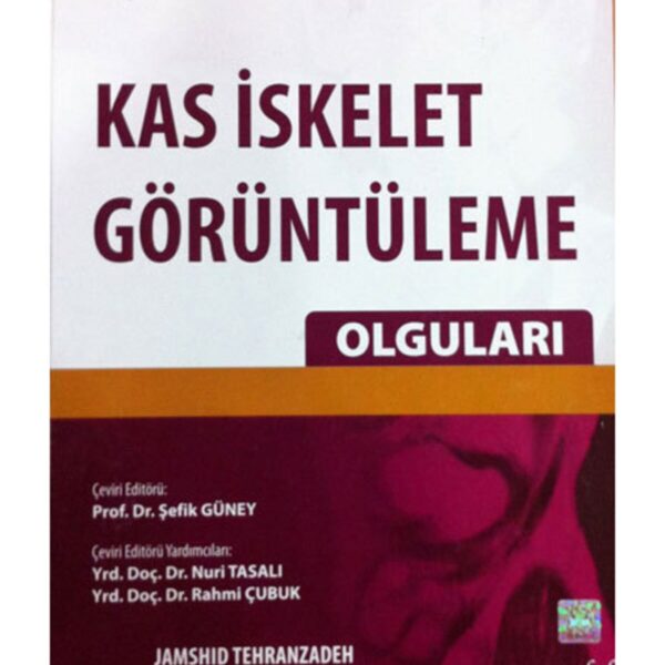 Kas İskelet Görüntüleme Olguları