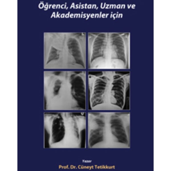 Klinik Akciğer Radyolojisi: Öğrenci, Asistan, Uzman ve Akademisyenler için