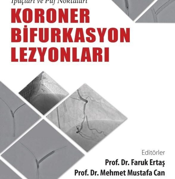 Koroner Bifurkasyon Lezyonları: Girişimsel Tedavi İpuçları ve Püf Noktaları