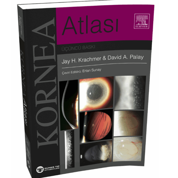Krachmer Kornea Atlası