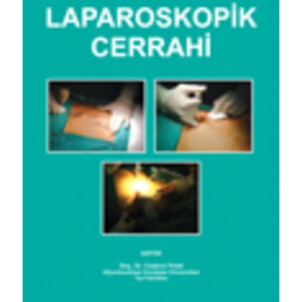 Laparoskopik Cerrahi