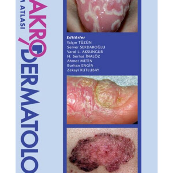Makro Dermatoloji Eğitim Atlası