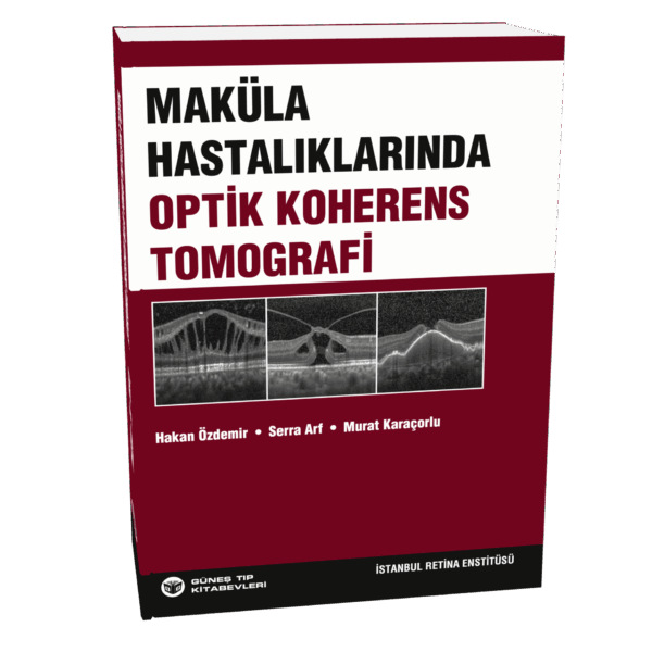Maküla Hastalıklarında Optik Koherens Tomografi