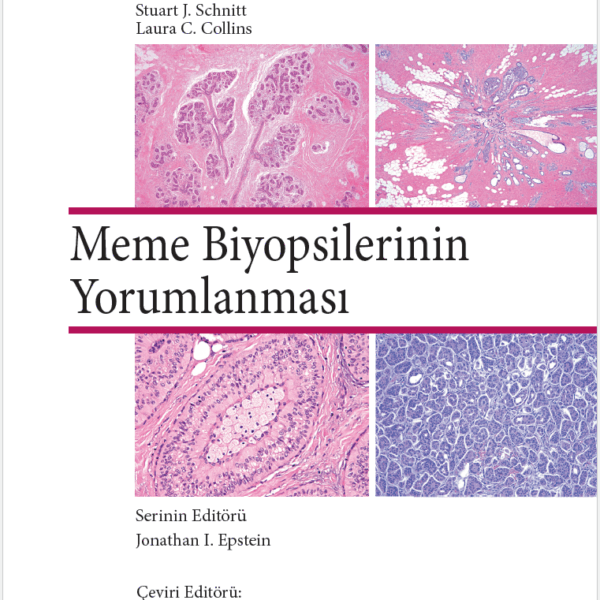 Meme Biyopsilerinin Yorumlanması