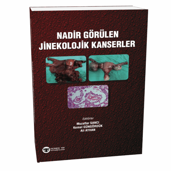 Nadir Görülen Jinekolojik Kanserler