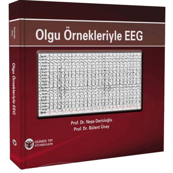 Olgu Örnekleriyle EEG
