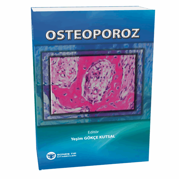 Osteoporoz