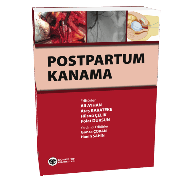 Postpartum Kanama