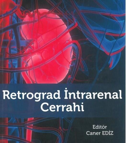 Retrograd İntrarenal Cerrahi