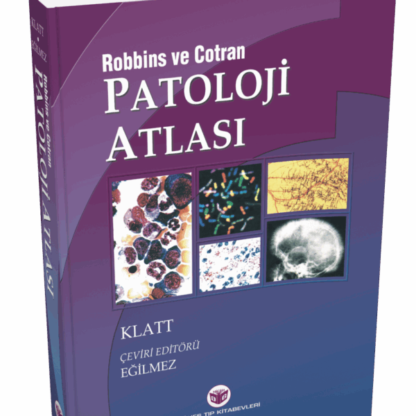 Robbins Patoloji Atlası