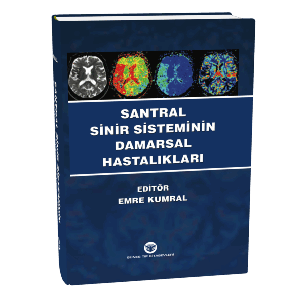 Santral Sinir Sisteminin Damarsal Hastalıkları