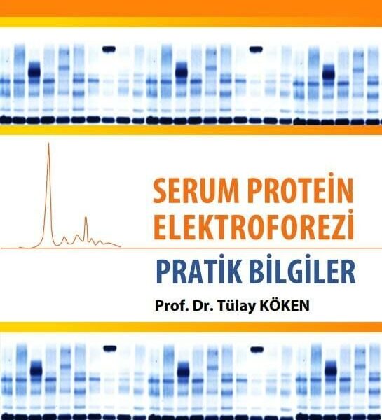 Serum Protein Elektroforezi: Pratik Bilgiler