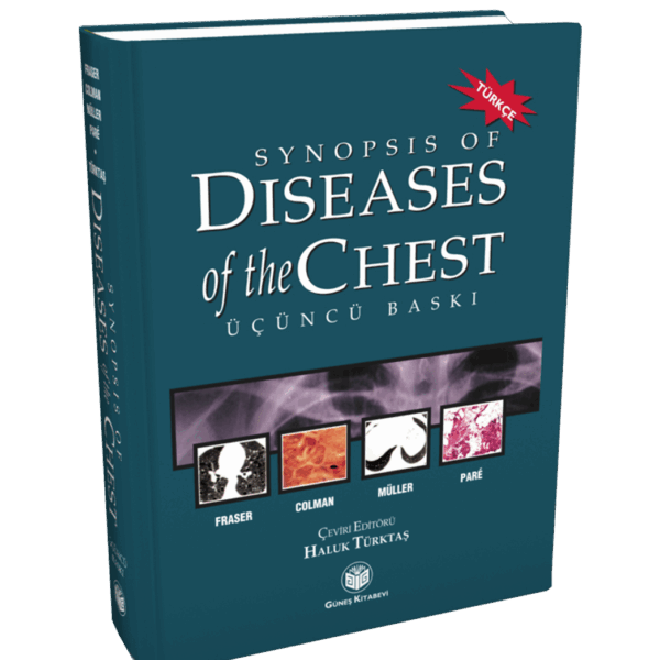 Synopsis of Diseases of The Chest (Türkçesi)