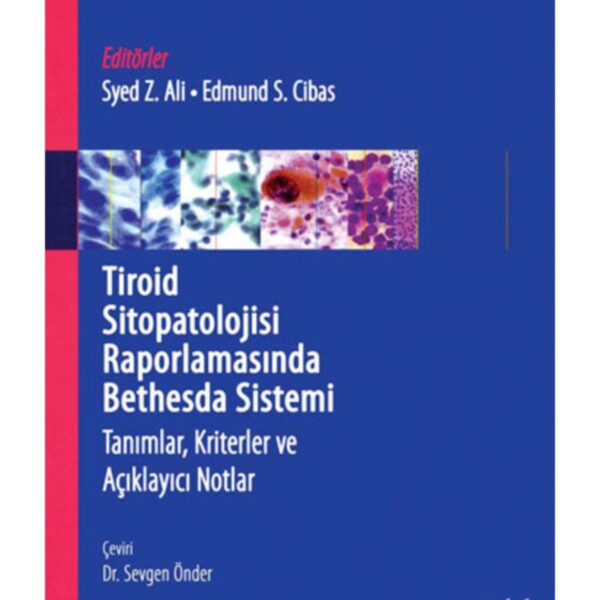 Tiroid Sitopatolojisi Raporlamasında Bethesda Sistemi: Tanımlar, Kriterler ve Açıklayıcı Notlar