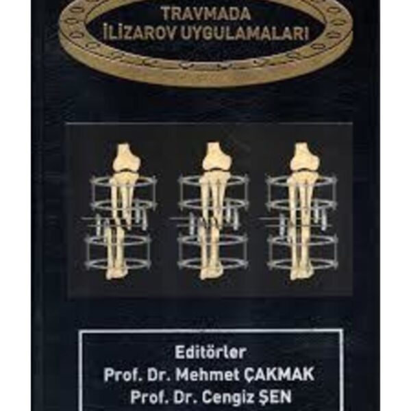Travmada İlizarov Uygulamaları
