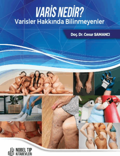 Varis Nedir ? Varisler Hakkında Bilinmeyenler