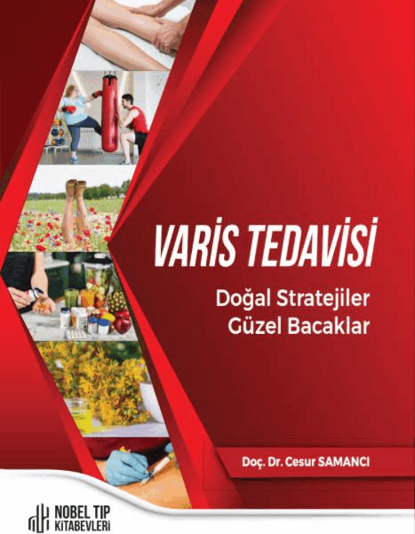 Varis Tedavisi Doğal Stratejiler,Güzel Bacaklar