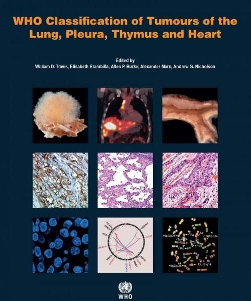 WHO Classification of Tumours of the Lung, Pleura,
