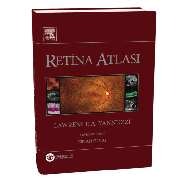 Yannuzzi Retina Atlası