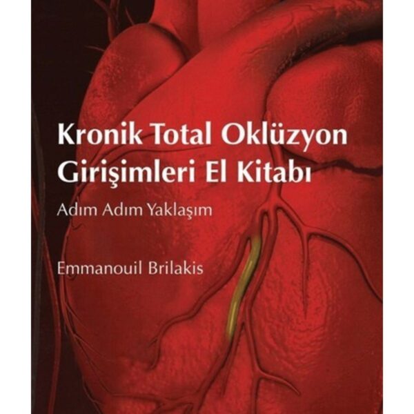 Kronik Total Oklüzyon Girişimleri El Kitabı: Adım Adım Yaklaşım