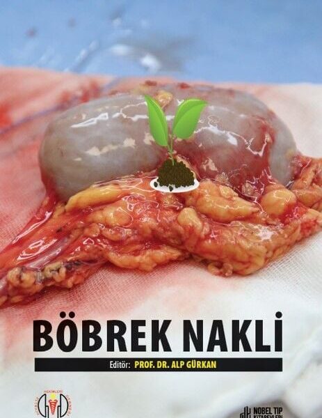 Böbrek Nakli