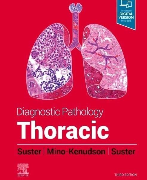 Diagnostic Pathology: Thoracic, 3rd Edition