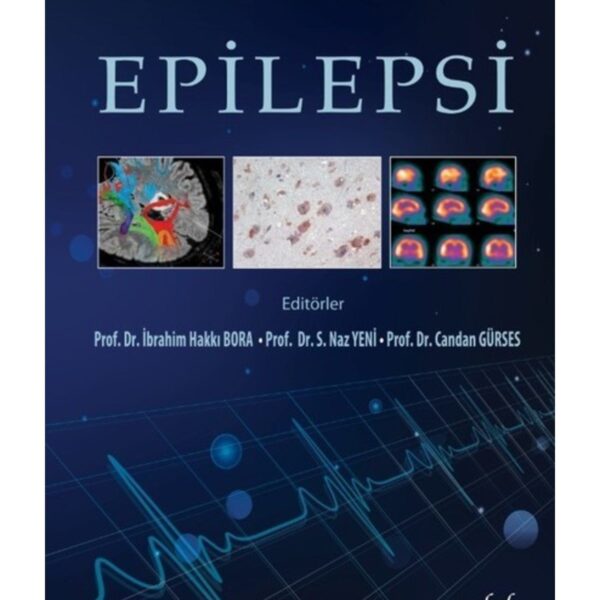 Epilepsi: Genişletilmiş İkinci Baskı