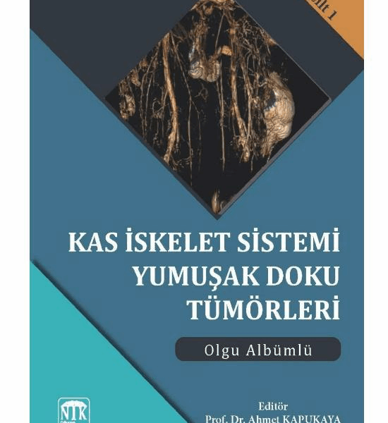 Kas İskelet Sistemi Yumuşak Doku Tümörleri Olgu Albümlü