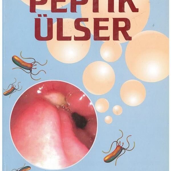 Peptik Ülser
