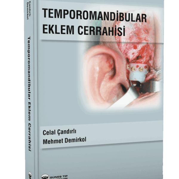 Temporomandibular Eklem Cerrahisi