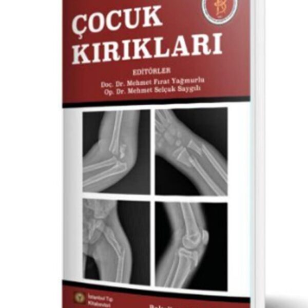 Çocuk Kırıkları
