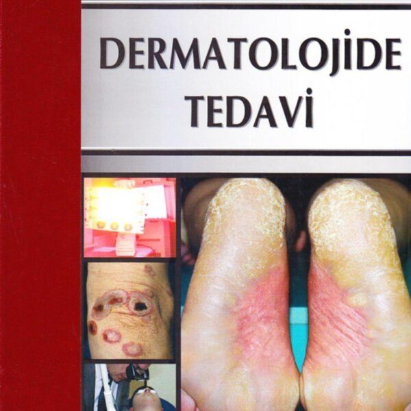 Dermatolojide Tedavi